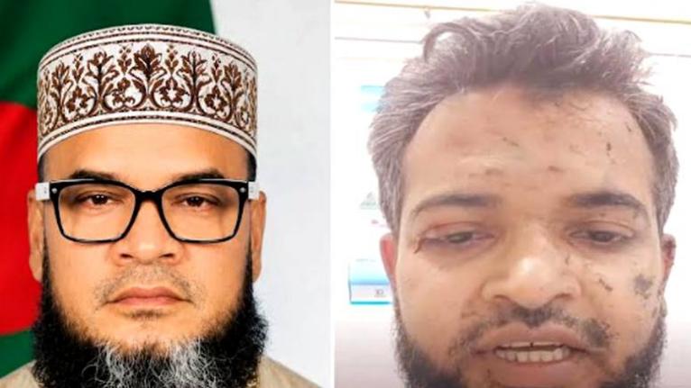 ভাণ্ডারিয়ায় দুই জামায়াত নেতার ওপর হামলার অভিযোগ, যুবদল নেতাকর্মীদের বিরুদ্ধে