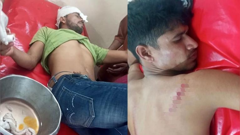 গণঅধিকার পরিষদের কার্যালয় নির্মাণ ঘিরে সংঘর্ষ, আহত ১৪