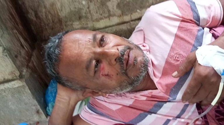 গলাচিপায় ইউপি সদস্যসহ ব্যবসায়ীকে পিটিয়ে আহত, হাসপাতালে ভর্তি