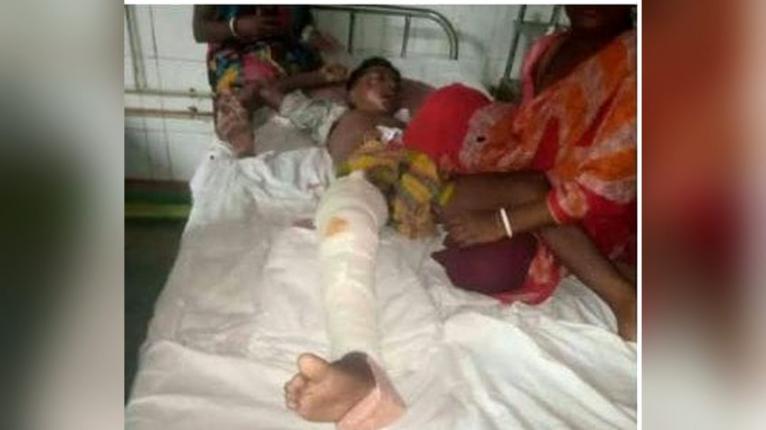 বরগুনায় গাছ থেকে পড়ে আহত শিক্ষার্থী, শিক্ষকের বিরুদ্ধে অভিযোগ