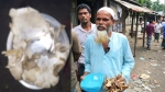 দুমকিতে ‘স্বপ্নে পাওয়া ফুল ও হাড়’ দিয়ে চিকিৎসার দাবি, বাড়ছে মানুষের ভিড়