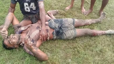মনপুরায় ইউপি সদস্যকে পিটিয়ে হাত-পা ভেঙে দিল দুর্বৃত্তরা