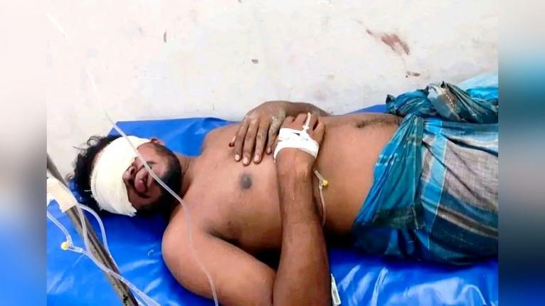 বোরহানউদ্দিনে মাইক্রোবাসে তুলে যুবকের চোখ উপড়ে ফেলার অভিযোগ, গ্রেপ্তার ১